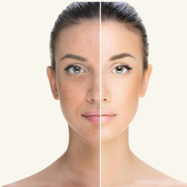 DARK SPOTS