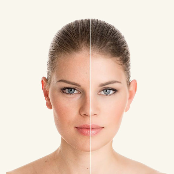 EVEN SKIN TONE