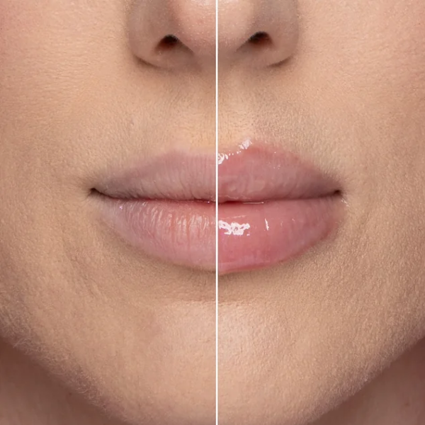 PLUMMING EFFECT ON LIPS