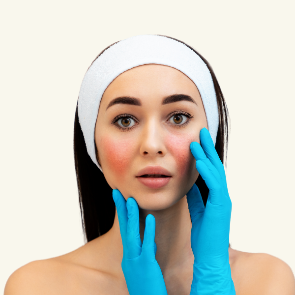 SENSITIVE SKIN