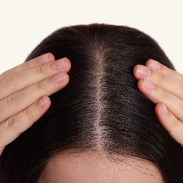 SMOOTH SCALP