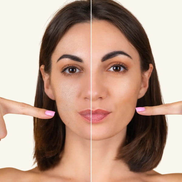 TIGHTEN PORES
